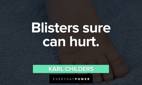 “Blisters sure can hurt.”– Karl Childers Sling Blade quotes about blisters